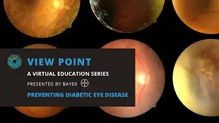 Diabetic Vision Loss: Prevention & Management
