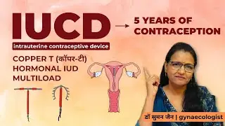 IUCD: Types, Benefits, Side Effects & Myths | IUD birth control in hindi | Ep 4 | Dr Suman Jain