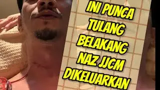 Naz Rahman Ngeri Bila Menceritakan Tulang Belakangnya Dikeluarkan