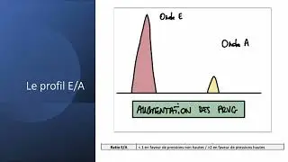 ECMU - Cardio :  H&eacute;modynamique