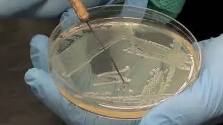 Mannitol Salt Agar