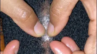 Scalp check and hair care routine #trending #viral #fyp #youtuber #youtubeshorts 