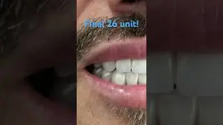 Final 25 unit insertion!