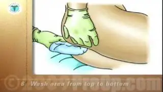 PostCare&trade; Patient Education Female Perineal Wash