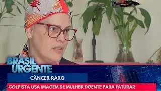 Mulher com c&acirc;ncer raro tem fotos usadas por golpista para faturar R$ 100 mil | Brasil Urgente