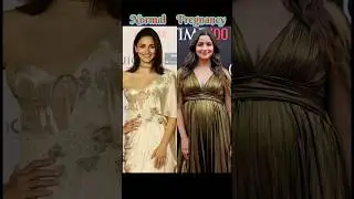 Bollywood Actress Normal VS Pregnancy Look Part 1 #youtubeshorts#ytshort#actress#normal#pregnancy