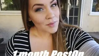1 Month Post Op VSG Surgery - Before and Now Pics