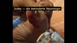 Versch&auml;rfte Pedik&uuml;re bei meiner Nagel-Psoriasis Teil 2