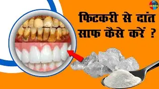 Fitkari से दांत साफ कैसे करें ? | Alum | Tooth Cleaning | Fitkiri se toothpaste kaise banaye #ghcare