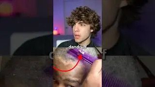 How to fix the 3 types of dandruff 😱