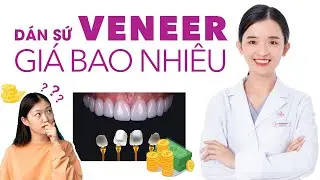 Top 3 Lưu Ý Khi Dán Sứ Veneer - Dán Sứ Veneer Giá Bao Nhiêu ? Dán Sứ Veneer ở đâu uy tín Hồ Chí Minh