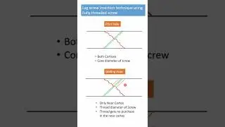 Lag screw insertion technique using fully threaded screw