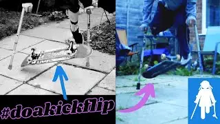 AMPUTEE ADELE LANDS HER FIRST EVER KICKFLIP!  with #commentary  #doakickflip #dreamscometrue #skater