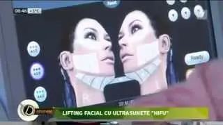 HIFU Lifting facial Clinica Estetic-Sana (Chisinau)