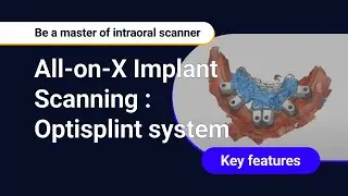 All-on-X Implant Scanning : Optisplint system