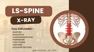 Lumbar Spine X-Ray | Views, Anatomy, Positioning, Exposure Factors & Indications Explained in Hindi