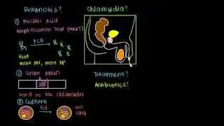 Diagnosis, Treatment, and Prevention of Chlamydia