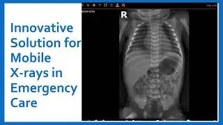 DHA2018_35: Mobile X ray