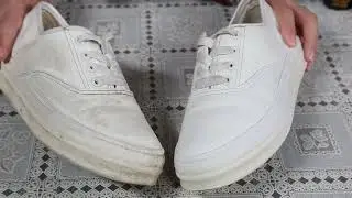 Ultimate White Shoe Cleaner &ndash; Instantly Remove Dirt & Yellow Stains!