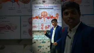 Cochlear implant: