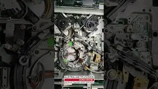 Would YOU Put Your Hands In This Machine? - Australian Television Archive