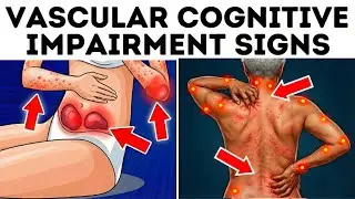 OVER 60: 10 Vascular Cognitive Impairment Signs (Doctors Rarely Mention #6)