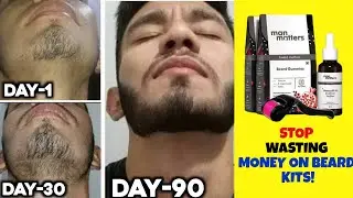Best Beard Growth Kit in India? | Man atters Beard Growth Kit Review | Minoxidil Beard Growth |