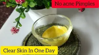 चेहरे के दाग | Instant Fair Skin | Remove Acne And Pimples | How To  Remove Acne, Pimples Marks