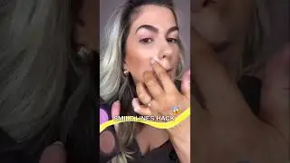 Shocking 😱 Smile Line Hack 🔥 #shorts #virralshorts #mekuphack #ytshorts  #trendingshorts