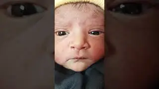 what happened to her #baby #babysleephelp #cutebaby #babysleepsack #cute #newborn #goodthing