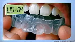 Meodental Natural+ whitening  Home Kit procedure video