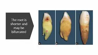 Quick revision part 3 Human Dentition 1 2026