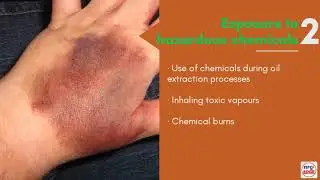 Health Hazards in the Oil and Gas industry