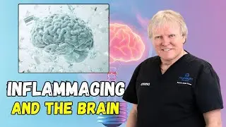Dr Patrick Treacy lectures on Inflammaging and the Brain