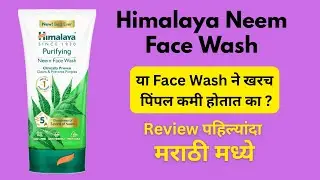 Himalaya Neem Face Wash खरंच काम करतो का? | Honest Review 