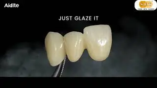 AIZIR - Just Glaze it, Premium Zirconia Block, Dental Cad Cam
