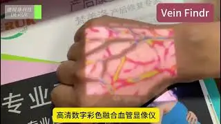 Color high-definition vascular imaging device, venous imaging device