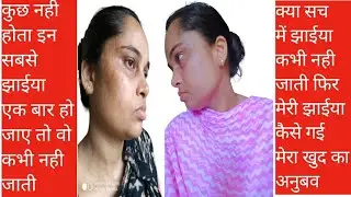 झाईया एक बार हो जाए तो कभी नहीं जाती? मेरी झाईया कैसे गई | Pigmentation Treatment Naturally
