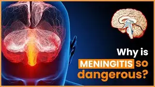Meningitis | Stay Fit With Health Tips | Dr Balvir S Tomar | NIMS Hospital | Healthcare