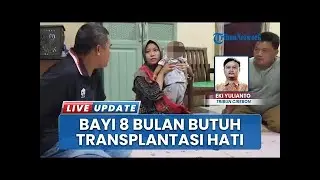 Kondisi Bayi 8 Bulan Asal Pangenan Cirebon Butuh Perhatian Khusus! Bayi Kembar Alami Penyakit Serius