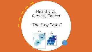 Shape Analysis of PAP Smears by Shape Genie