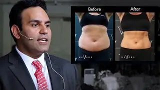 How CoolSculpting Works Live | Revere Clinics