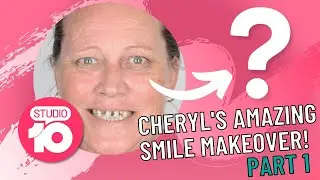 Cheryl's Amazing Smile Makeover PART ONE | Studio 10