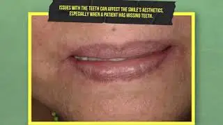 Beautiful smile makeover by Dr. Farber!