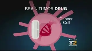 Dr. Max Gomez: Brain Tumor Vaccine