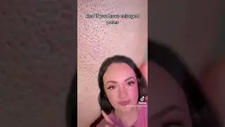 ENLARGED PORES❓ PATCHY MAKEUP❗️❓