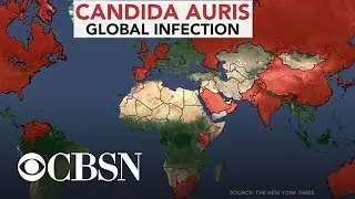 Drug-resistant superbug fungus sickens hundreds across the U.S.