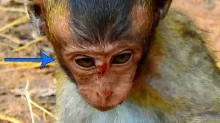Look Baby Lori So Tired and Exhausted While Her Face Is Swelling Bigger and Bigger|So Pity This Poor