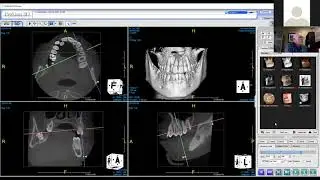 PreXion Online Presentation: 