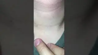 Suprasternal Notch Pulse